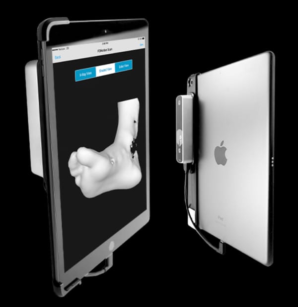 The tablet based three dimensional foot scanning system